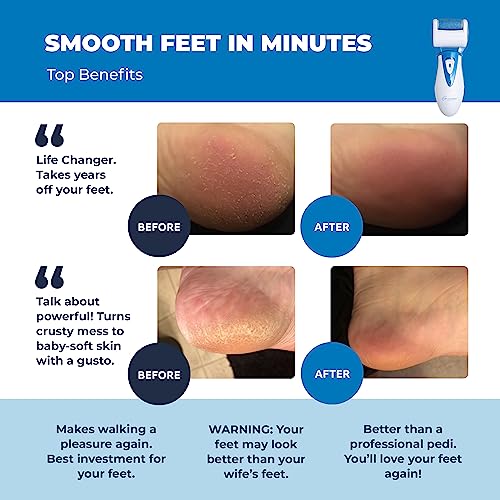 Rechargeable Electric Foot Callus Remover with Spa-Quality Pedicure Tools
