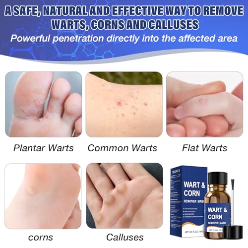 Mitreal Wart Remover Liquid with Salicylic Acid - Fast Acting for Warts, Corns & Calluses - 15ml