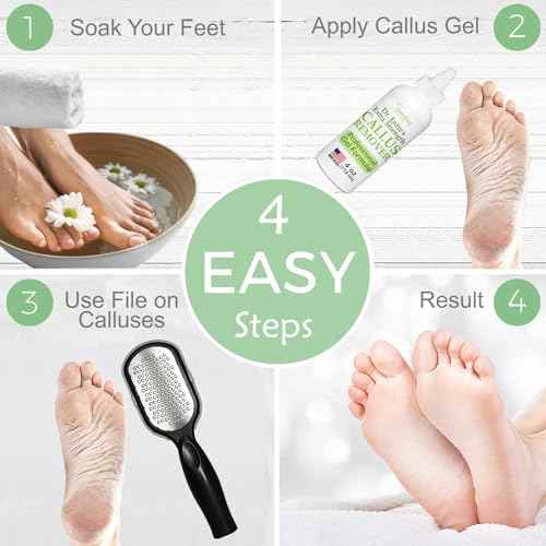 Dr. Entre's Callus Remover Gel & Foot File: Extra Strength Callus Remover for Feet, Foot Callus Remover Care, Pedicure Tools Supplies, Spa Kit, Dead Skin Scrubber, 4 oz
