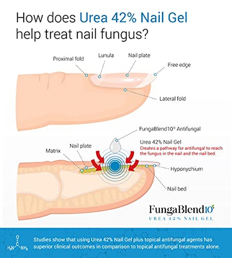 FungaBlend 10 Urea 42% Nail Gel for Fast Fungus Treatment