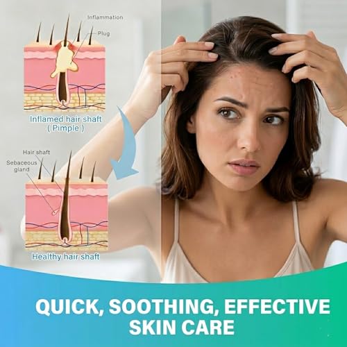 Folliculitis Treatment Cream with Tea Tree Oil - 60ml Soothing Care