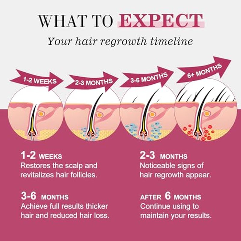 5% Minoxidil Hair Regrowth Spray for Women with Biotin