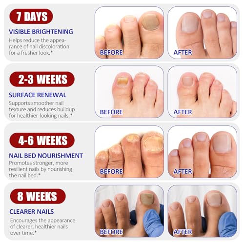Overnight Toenail Care Patches for Dry & Damaged Nails - 2 Pack
