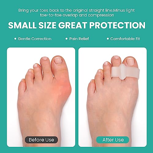 Bunion Corrector Toe Separators (12 Pack) – Aloe Vera Gel