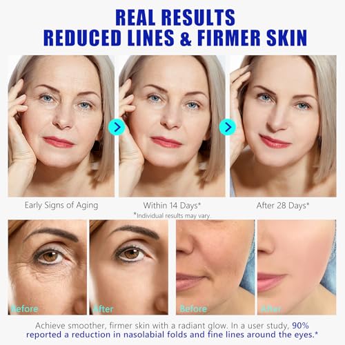 Stem Cell Serum for Face, Stem Cell Anti-Aging Serum for Women, Supports Anti-Wrinkle, Hydrate, Firm & Improve Skin Elasticity, and Renew Your Skin for a Youthful Glow (1.2 Fl Oz)
