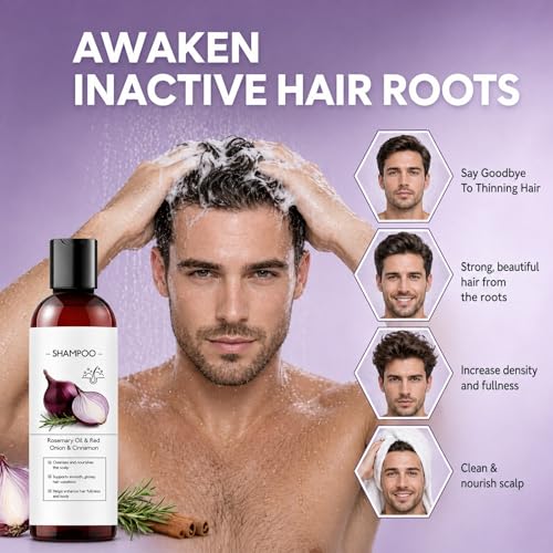 Onion Shampoo for Hair Growth - Anti Hair Loss Treatment