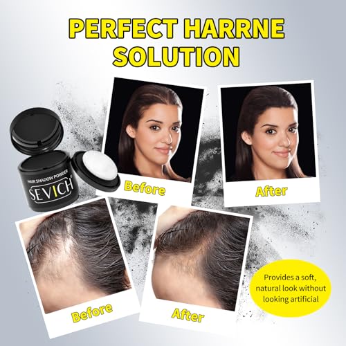 Sevich Hairline Powder 10g - Waterproof Hair Loss Concealer, Dark Brown