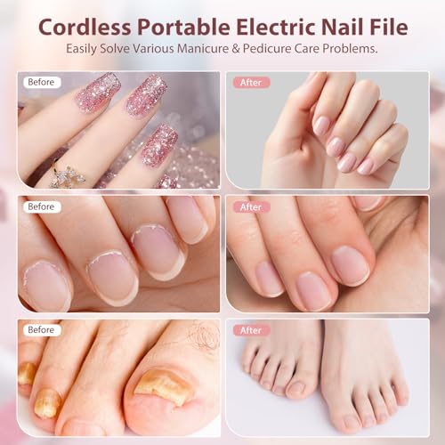 Professional Electric Nail Drill Kit for Manicure & Pedicure