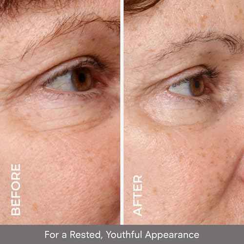 COSMEDIX Under Eye Serum for Dark Circles & Puffiness, Opti Crystal - Lifting & Firming Liquid Serum for Fine Lines & Wrinkles - Brightening, Moisturizing, & Hydrating Anti Aging Eye Puffy Bags Serum