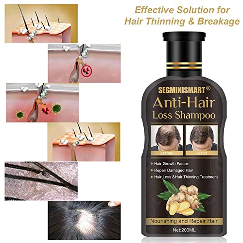 Hair Growth Shampoo,Anti-Hair Loss Shampoo,Hair Thickening Shampoo Helps Stop Loss, for Stronger, Thicker, Longer