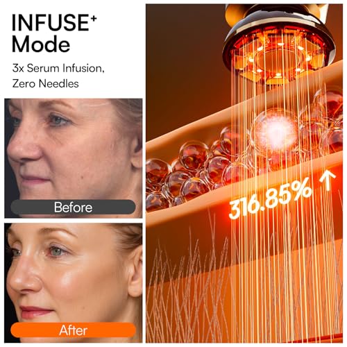 INIA Flare 3-in-1 Microcurrent Facial Device with Red Light Therapy - White