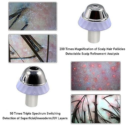 Skin & Hair Analyzer with 11" LCD Screen, 50X 200X Magnification