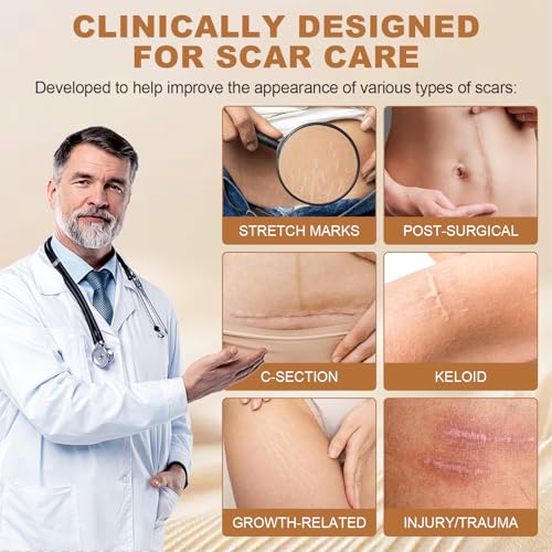 Silicone Scar Sheets for C-Section & Surgery - 3M Roll (1.6"x118") - Reusable & Hypoallergenic Scar Tape to Fade Scars from Acne, Burns, Keloid | Doctor Recommended