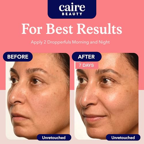 Caire ¡®Own Your Age¡¯ Hyaluronic Acid Peptide Deep Infusing Serum for Face, Eyes + Neck | Wrinkle Fighting, Collagen Generation for Women Over 40 | 30ml