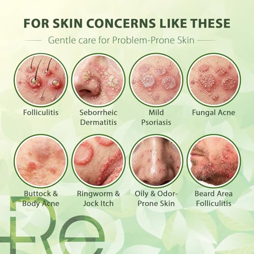 Recuren Plus Antifungal Body Wash - Back Acne & Jock Itch Relief
