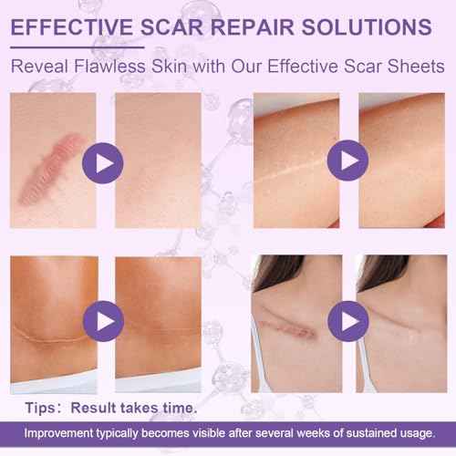 Silicone Scar Sheets, Advanced Medical Silicone Scar Tape(1.6"x 60"Roll-1.5M), Professional Grade Scar Removal Strip for Surgery, Tummy, Mouth, Face, C Section, Burn, Keloid, Acne Scars etc