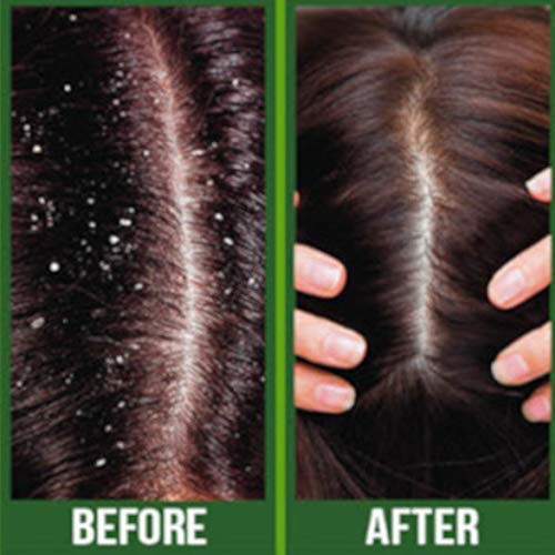 Difeel Premium Castor Plus Tea Tree - Pro-Growth + Scalp Care Premium Hair Oil 2.5 oz.