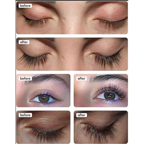 TOPLASH XL Lash and Brow Booster, Growth Serum with Eyelash and Eyebrow Enhancer, Promotes Stronger, Thicker, Healthier Lashes with Botanicals and Peptides - 0,2 Fl Oz(6 ml)