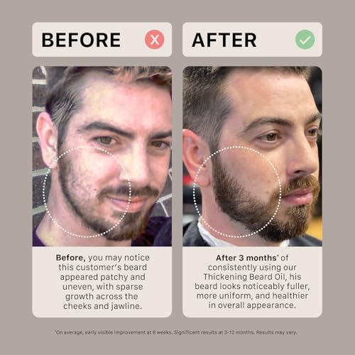 ACTIIV Thickening Beard Oil | Promotes Thicker Fuller Beard Growth, Nourishes & Softens Facial Hair, Lightweight Non-Greasy Formula, Vegan, Plant-Based, All Beard Types