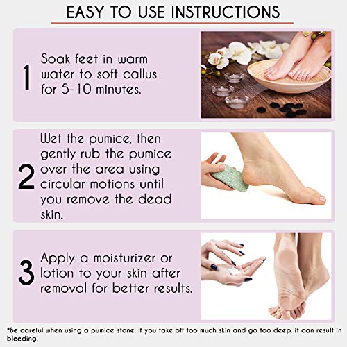 Karlash 2-Sided Foot Pumice Stone Callus Remover Scrubber (2 Pack)