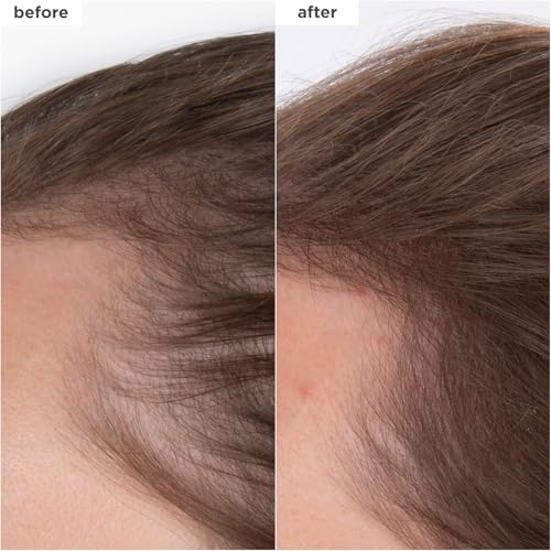 Briogeo Destined For Density MegaStrength+ Caffeine + Biotin Peptide Density Serum, Increases Hair Thickness and Volume, Fast-Absorbing & Non-Greasy, Fragrance-Free, Vegan, Cruelty-Free, 1.5 fl oz