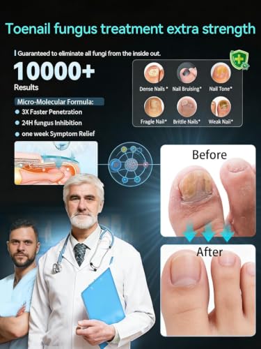 Gembooxt Toenail Fungus Treatment Pen with Tea Tree Oil & Undecylenic Acid