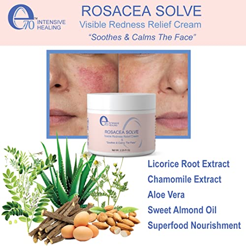 e70 Rosacea Solve - Redness Relief Cream - Face Moisturizer For Rosacea & Acne Prone Skin - Sensitive Skin Care With Organic Ingredients, Almond Oil, Licorice & Chamomile Extracts - No Parabens