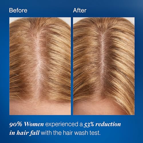 Biotin 10000mcg Gummies for Hair Growth - Women & Men
