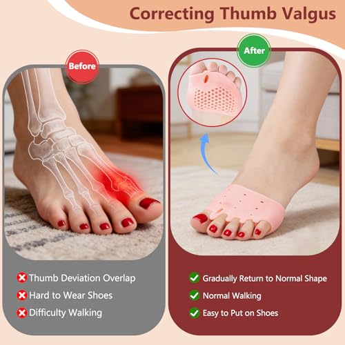 Silicone Toe Spacers 4 Pairs - Medical Grade Gel Separators