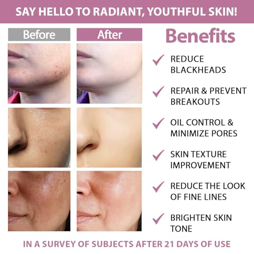 Glycolic Acid 20% & Salicylic Acid 2% Face Exfoliating Pads (50 Count)- Facial Peel Pads for Anti-Aging, Cleansing, Resurfacing, Brightening, Blemish Control, Revealing Clear, Glowing, Youthful Skin