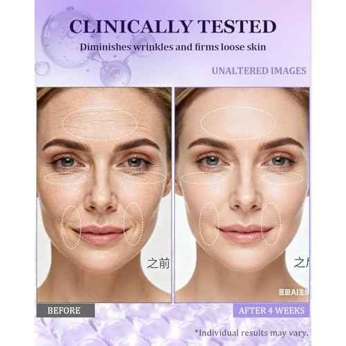 Neck Firming Cream for Tightening | Anti-Aging Face Moisturizer for Women | 1% Retinol + 7% Hyaluronic Acid for Firming & Wrinkle Reduction | Day & Night Use for Neck & D?collet?, 1.7 Fl Oz