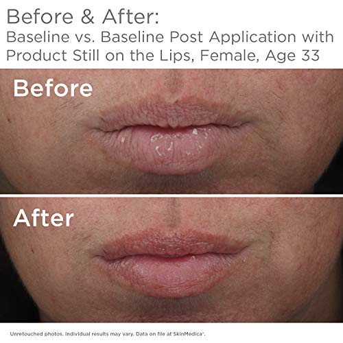 SkinMedica HA5 Smooth & Plump Lip System 0.05 Oz