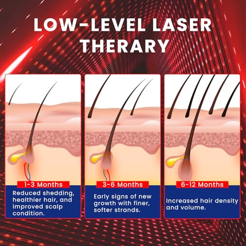 Oiameen Hair Growth Cap 650nm LLLT Red Light Therapy