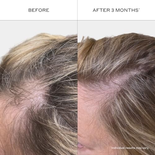 Zenagen Revolve Women's Thickening Shampoo 6 Fl Oz - 5 Minute Hair Treatment for Thinning Hair