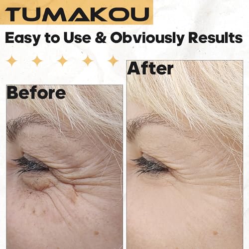 TUMAKOU High Frequency Tongue Glass Tube Replacement