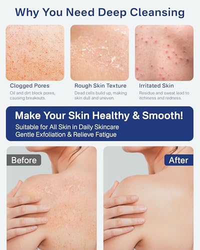 Yiclick Heavy Exfoliating Gloves Mitts for Dead Skin Removal