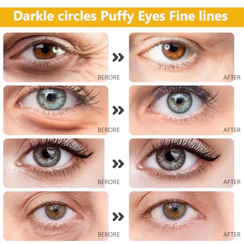 24K Gold Eye Masks & Collagen Lip Patches - 30 Pack Set