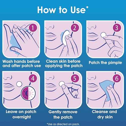 Clearasil Day and Night Acne Spot Patches, Hydrocolloid Technology, Value Pack, 30 Count