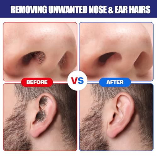 Nose Wax Kit, 120 g Wax, 30 Applicators,Nostril and Ears Hair Removal Kit for Men & Women,Includes 15 Balm Wipes and Mustache Guards etc. Lasts up to 6 Weeks