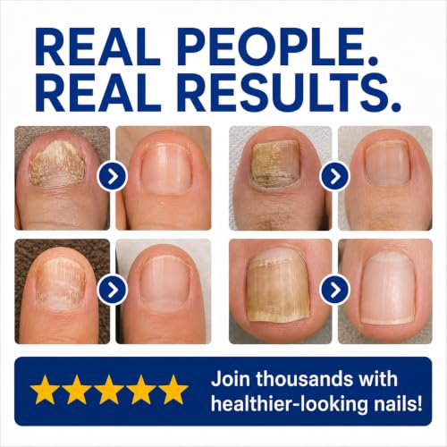 Approved Science Fungix Extra Strength Undecylenic Acid & Tea Tree Nail Serum
