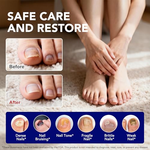 VOFANK Toenail Fungus Pen with 25% Undecylenic Acid - Extra Strength Nail Treatment for Discolored, Damaged Nails