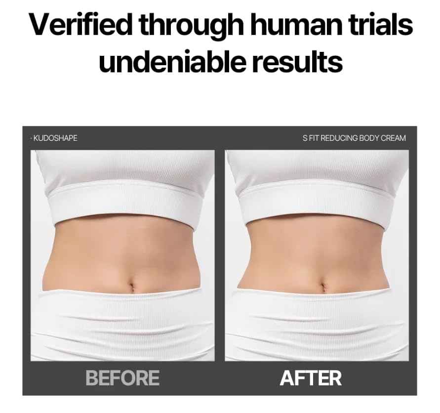 Kudoshape S-Fit Reducing Body Cream 145ml (4.9 fl. oz) – Moisturizing Body Lotion with Massage Roller | BHA & Natural Extracts for Smoother, Toned-Looking Skin | Korean Skincare