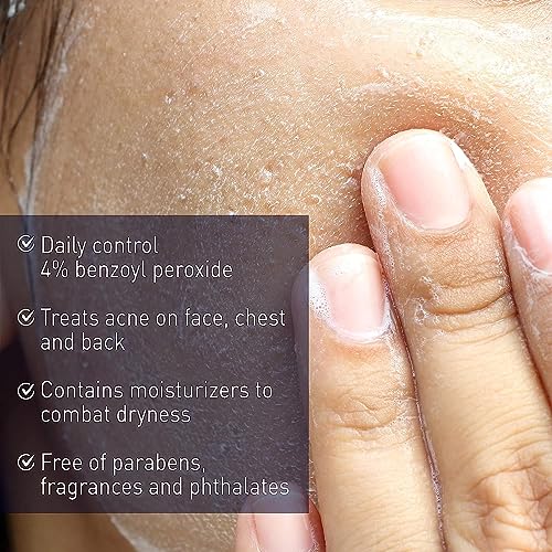 PanOxyl 4 Acne Creamy Wash, 4% Benzoyl Peroxide 6 oz (Pack of 5)