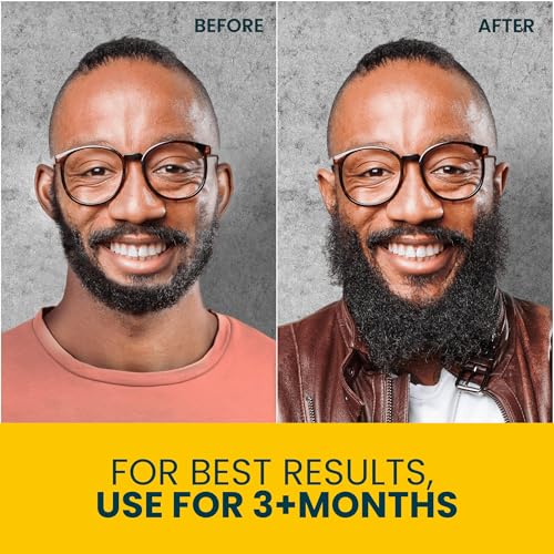 Beard Oil for Black Men with Sensitive Skin - Non Comedogenic Beard Oil - Safe for Acne Prone Skin - Unscented, Soothing, Natural, Lightweight and Non Greasy 2oz