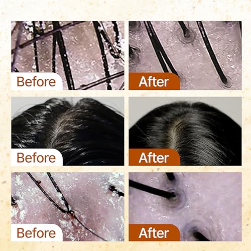 GROWUS Sea Salt Clarifying Shampoo for Oily Scalp - 16.9 fl. oz.