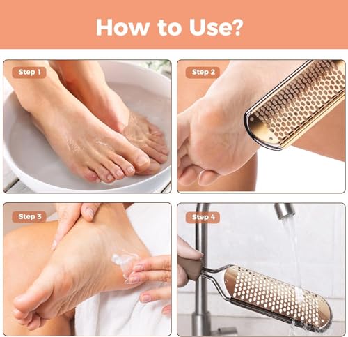 Easkep Stainless Steel Foot File Callus Remover