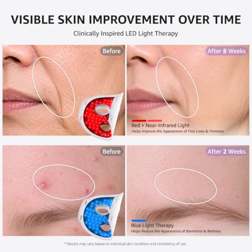 Aesthifae Red Light Therapy Mask - 468 LED Face, Neck & Chest