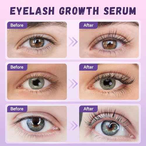 Lash Serum: Eyelash Growth Serum Gentle Natural Vegan Enhancing Treatment Nourishing Conditioning Formula for Longer Thicker Fuller Natural Lashes -5ml