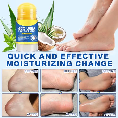 FANSHI 60% Urea Stick for Dry Cracked Heels - 2 Pack Exfoliating Foot Balm