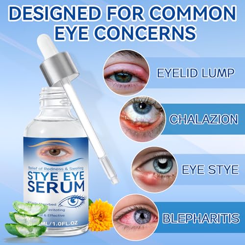 Stye Eye Treatment Serum 30ml - Natural Relief for Styes & Blepharitis